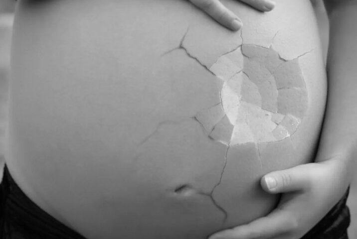 My Voice, My CHoice aborto
